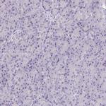 RPGRIP1 Antibody in Immunohistochemistry (Paraffin) (IHC (P))