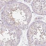 RPGRIP1 Polyclonal Antibody