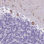PAK3 Antibody in Immunohistochemistry (Paraffin) (IHC (P))