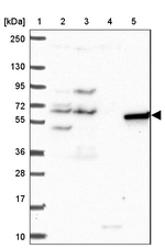 PAK3 Antibody in Western Blot (WB)