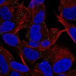 MYT1L Polyclonal Antibody