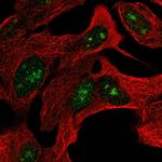 ZNF790 Polyclonal Antibody