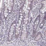SENP3 Antibody in Immunohistochemistry (Paraffin) (IHC (P))