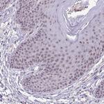 SENP3 Antibody in Immunohistochemistry (Paraffin) (IHC (P))