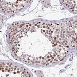 SENP3 Antibody in Immunohistochemistry (Paraffin) (IHC (P))