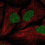 JRKL Polyclonal Antibody