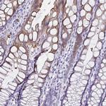 TPSG1 Antibody in Immunohistochemistry (Paraffin) (IHC (P))