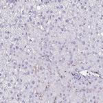 TPSG1 Antibody in Immunohistochemistry (Paraffin) (IHC (P))