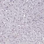 MTGR1 Polyclonal Antibody