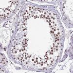 MTGR1 Antibody in Immunohistochemistry (Paraffin) (IHC (P))