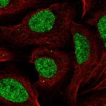 CCDC12 Polyclonal Antibody