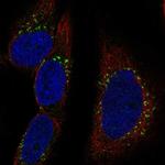 RAB30 Polyclonal Antibody