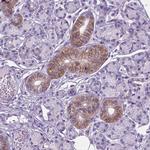BSND Antibody in Immunohistochemistry (Paraffin) (IHC (P))