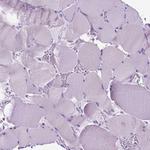 BSND Antibody in Immunohistochemistry (Paraffin) (IHC (P))