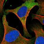 Cytohesin 2 Polyclonal Antibody