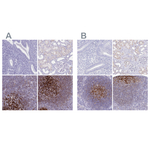 CD21 Antibody in Immunohistochemistry (Paraffin) (IHC (P))