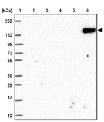 CD21 Antibody in Western Blot (WB)