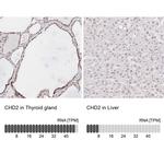 CHD2 Antibody