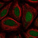 CHD2 Polyclonal Antibody