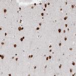 CHD2 Antibody in Immunohistochemistry (Paraffin) (IHC (P))