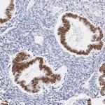 CHD2 Antibody in Immunohistochemistry (Paraffin) (IHC (P))