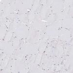 CHD2 Antibody in Immunohistochemistry (Paraffin) (IHC (P))