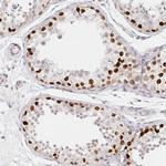 CHD2 Antibody in Immunohistochemistry (Paraffin) (IHC (P))