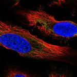 PLA2 Polyclonal Antibody