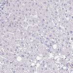 PLA2 Antibody in Immunohistochemistry (Paraffin) (IHC (P))