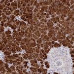 PLA2 Antibody in Immunohistochemistry (Paraffin) (IHC (P))
