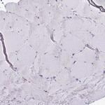 PLA2 Antibody in Immunohistochemistry (Paraffin) (IHC (P))