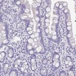 PLA2 Antibody in Immunohistochemistry (Paraffin) (IHC (P))