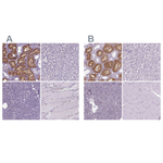 CLIC4 Polyclonal Antibody