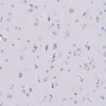 CD5 Antibody in Immunohistochemistry (Paraffin) (IHC (P))