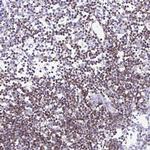 CD5 Antibody in Immunohistochemistry (Paraffin) (IHC (P))