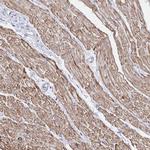 RhoBTB2 Antibody in Immunohistochemistry (Paraffin) (IHC (P))