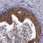 LCN9 Polyclonal Antibody