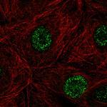 DCAKD Polyclonal Antibody