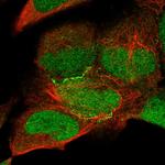 KIAA0895 Polyclonal Antibody