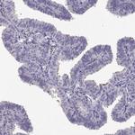 C9orf171 Antibody in Immunohistochemistry (Paraffin) (IHC (P))