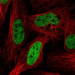 SUGP2 Polyclonal Antibody