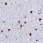SUGP2 Antibody in Immunohistochemistry (Paraffin) (IHC (P))