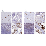 SUGP2 Antibody in Immunohistochemistry (Paraffin) (IHC (P))