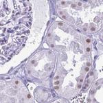 SUGP2 Antibody in Immunohistochemistry (Paraffin) (IHC (P))