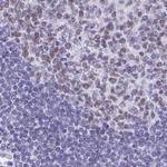 SUGP2 Antibody in Immunohistochemistry (Paraffin) (IHC (P))
