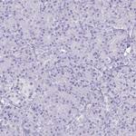 SUGP2 Antibody in Immunohistochemistry (Paraffin) (IHC (P))