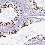 SUGP2 Antibody in Immunohistochemistry (Paraffin) (IHC (P))