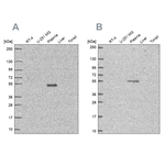 EED Antibody in Western Blot (WB)