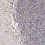LONRF3 Polyclonal Antibody