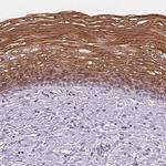 Cytokeratin 6A Antibody in Immunohistochemistry (Paraffin) (IHC (P))